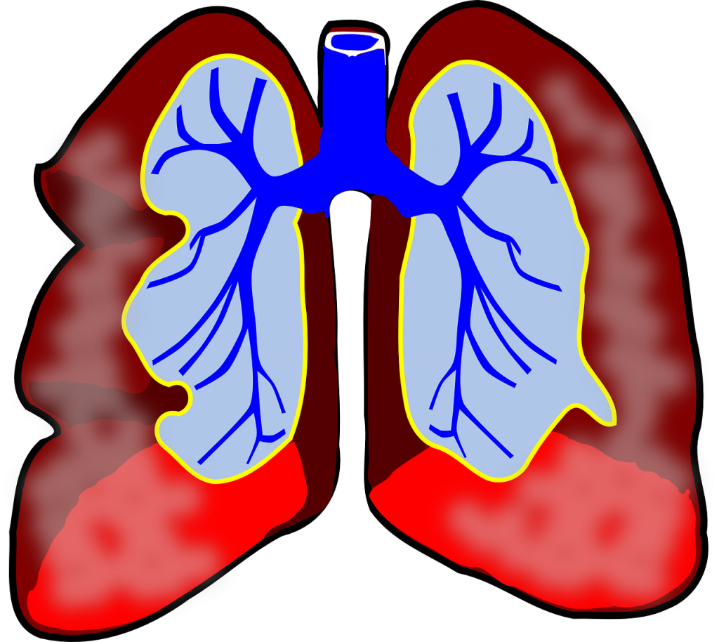 mesotelioma y sus causas