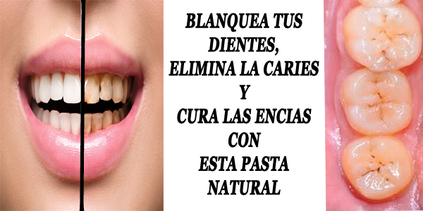eliminar la carie de los dientes
