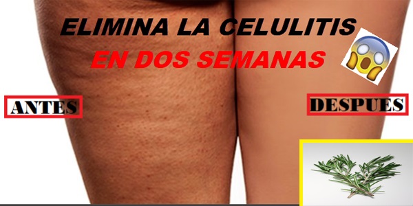 COMO ELIMINAR LA CELULITIS