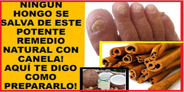 ELIMINAR LOS HONGOS C