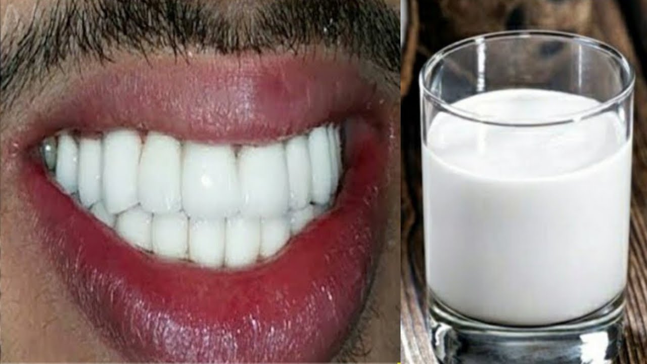 No Hay Necesidad De Ir Al Dentista: Eliminar La Placa Dental Y El Sarro Solo Con Esta Mezcla