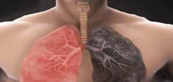 como limpiar tu pulmones si eres fumador