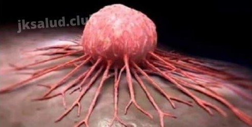 EL CANCER ES PRODUCIDO POR LA DEFICIENCIA DE ESTAS VITAMINAS